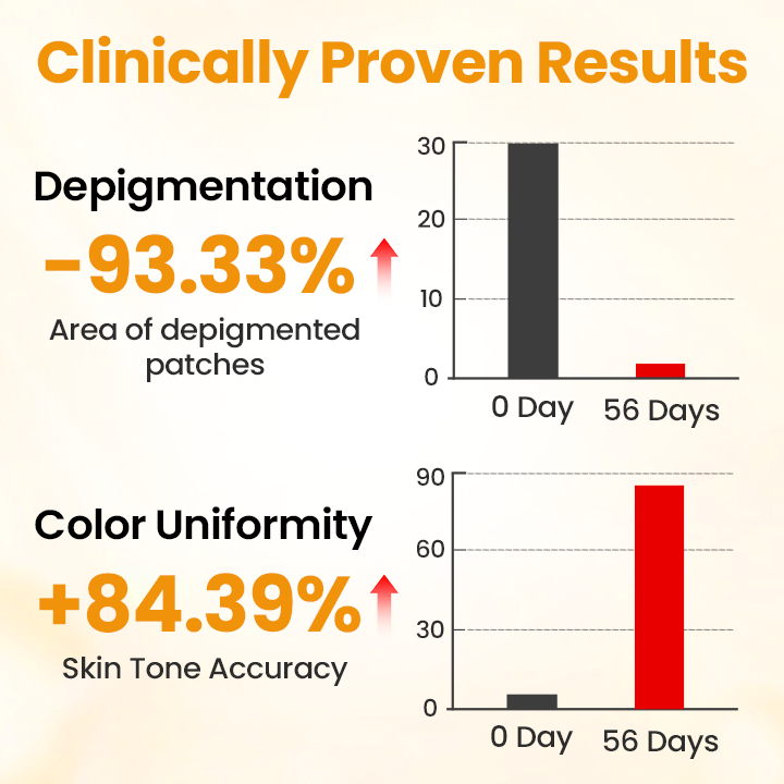 Lovilds® VitiGone Rapid Spray — 2–3 Week Repigmentation with OTDS