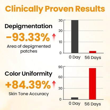 Lovilds® VitiGone Rapid Spray — 2–3 Week Repigmentation with OTDS