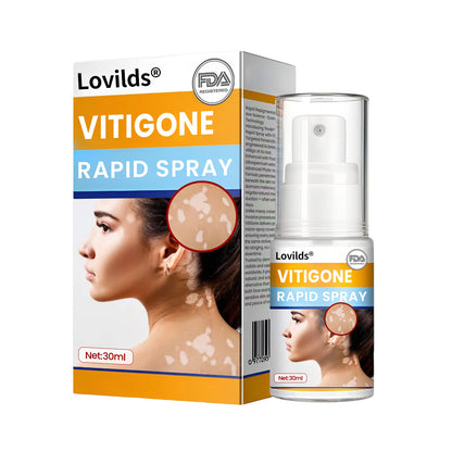 Lovilds® VitiGone Rapid Spray — 2–3 Week Repigmentation with OTDS