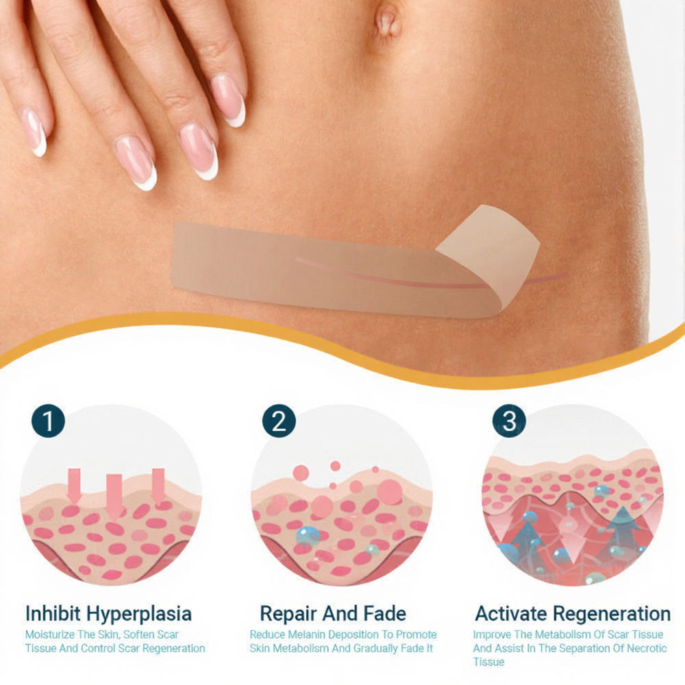 🍍Official Store |Cheemex® Hyaluronic Acid Nano Microneedle Repair Tape🗽🎉(Treatment of old and new scars, reduction of surgical scars, stretch marks, keloids, acne, burns, warts, dermatomes and varicose veins)