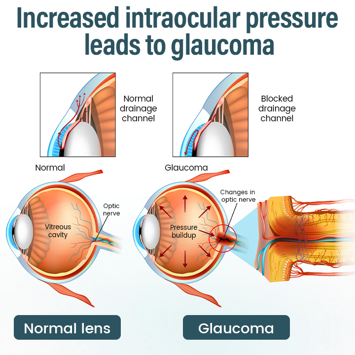 Mayo Clinic recommends👨‍⚕️:  Nano Eye Drops Serum