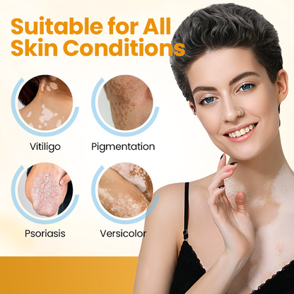 Lovilds® VitiGone Rapid Spray — 2–3 Week Repigmentation with OTDS